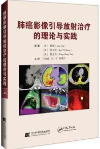 肺癌影像引导放射治疗的理论与实践