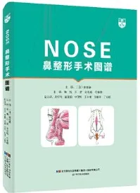 鼻整形手术图谱