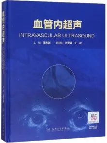血管内超声