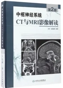 中枢神经系统CT和MRI影像解读 第2版