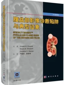 腹盆部影像诊断陷阱与典型征象