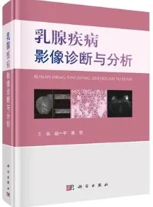 乳腺疾病影像诊断与分析