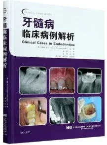 牙髓病临床病例解析
