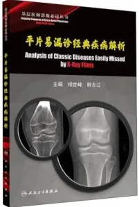 平片易漏诊经典疾病解析