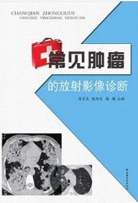常见肿瘤的放射影像诊断