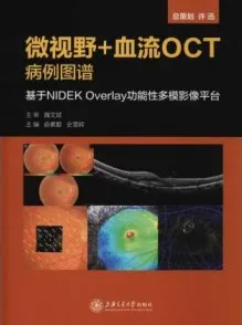 微视野＋血流OCT病例图谱