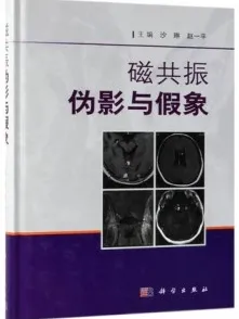 磁共振伪影与假象