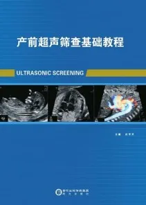 产前超声筛查基础教程