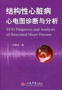 结构性心脏病心电图诊断与分析