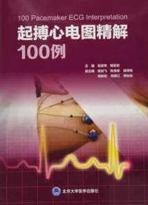 起搏心电图精解100例