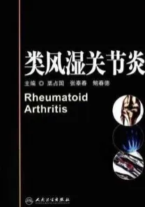 类风湿关节炎