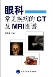 眼科常见疾病的CT及MRI图谱