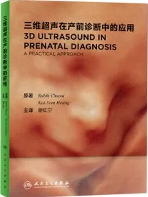 三维超声在产前诊断中的应用