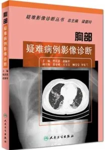 胸部疑难病例影像诊断