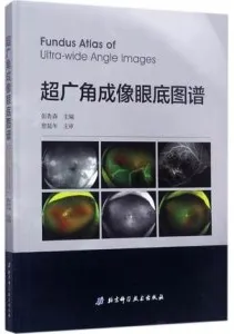 超广角成像眼底图谱