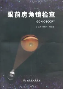 眼前房角镜检查