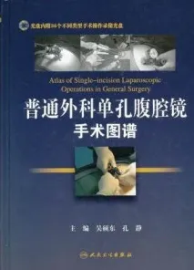 普通外科单孔腹腔镜手术图谱