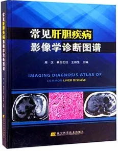 常见肝胆疾病影像学诊断图谱