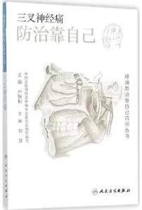 三叉神经痛（2015）