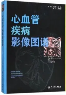 心血管疾病影像图谱
