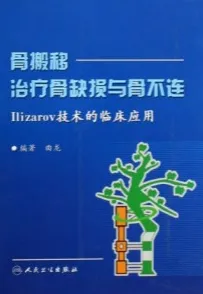 骨搬移治疗骨缺损与骨不连 Ilizarov技术的临床应用