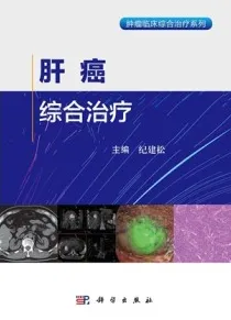 肝癌综合治疗