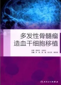 多发性骨髓瘤造血干细胞移植