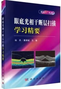 眼底光相干断层扫描学习精要