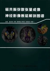 磁共振弥散张量成像神经影像断层解剖图谱