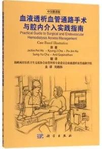 血液透析血管通路手术与腔内介入实践指南
