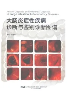 大肠炎症性疾病诊断与鉴别诊断图谱