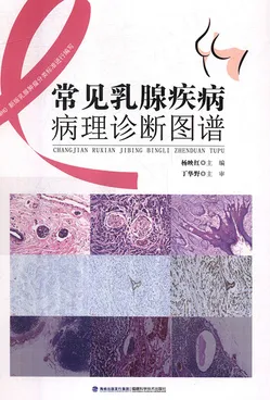 常见乳腺疾病病理诊断图谱