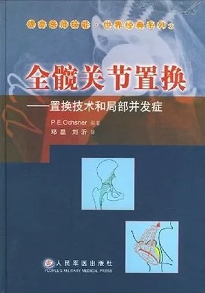 全髋关节置换：置换技术和局部并发症