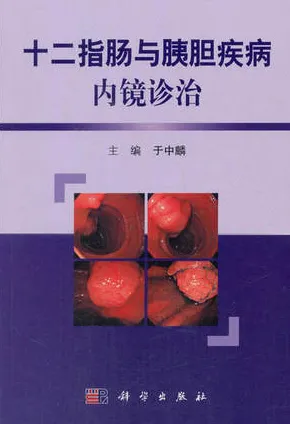 十二指肠与胰胆疾病内镜诊治 第2版