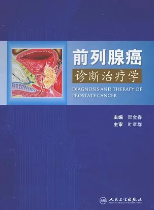 前列腺癌诊断治疗学