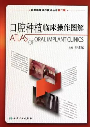 口腔种植临床操作图解