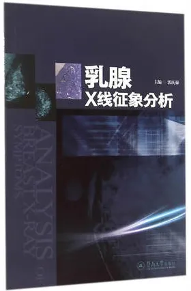 乳腺X线征象分析