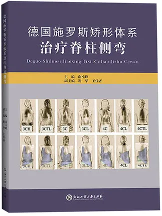 德国施罗斯矫形体系治疗脊柱侧弯