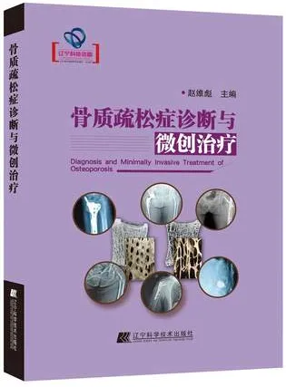 骨质疏松症诊断与微创治疗