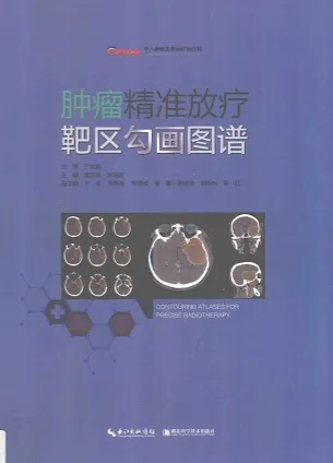 肿瘤精准放疗靶区勾画图谱