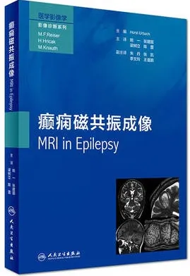 癫痫磁共振成像