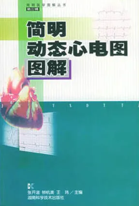 简明动态心电图图解