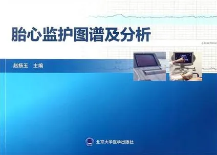 胎心监护图谱及分析