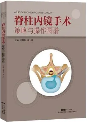 脊柱内镜手术策略与操作图谱