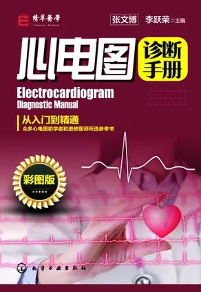 心电图诊断手册（彩图版）
