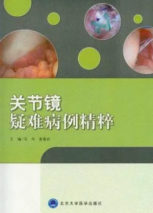 关节镜疑难病例精粹