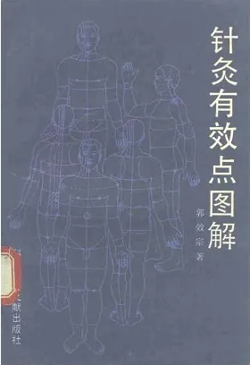 针灸有效点图解