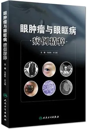 眼肿瘤与眼眶病病例精粹