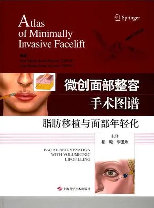微创面部整容手术图谱 脂肪移植与面部年轻化