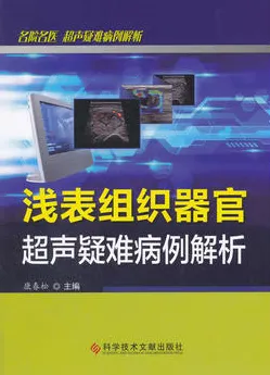 浅表组织器官超声疑难病例解析